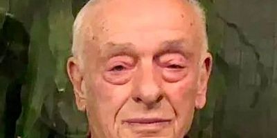 Cevdet Bağdat Beyin Kanaması geçirdi